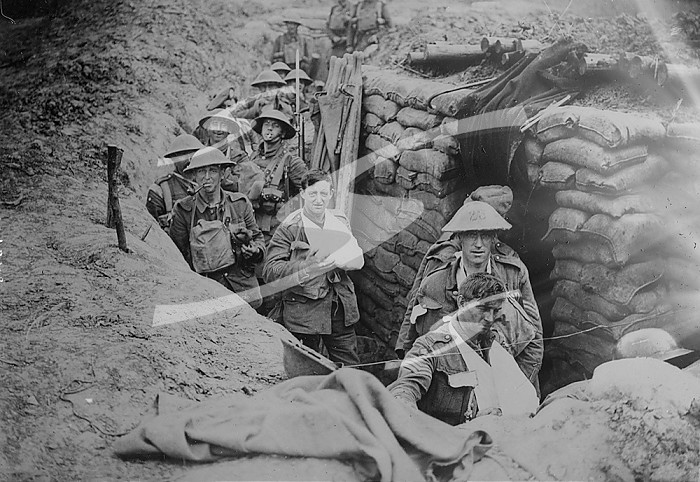 Wounded British in trench, 18 Aug 1918. Creator: Bain News Service.