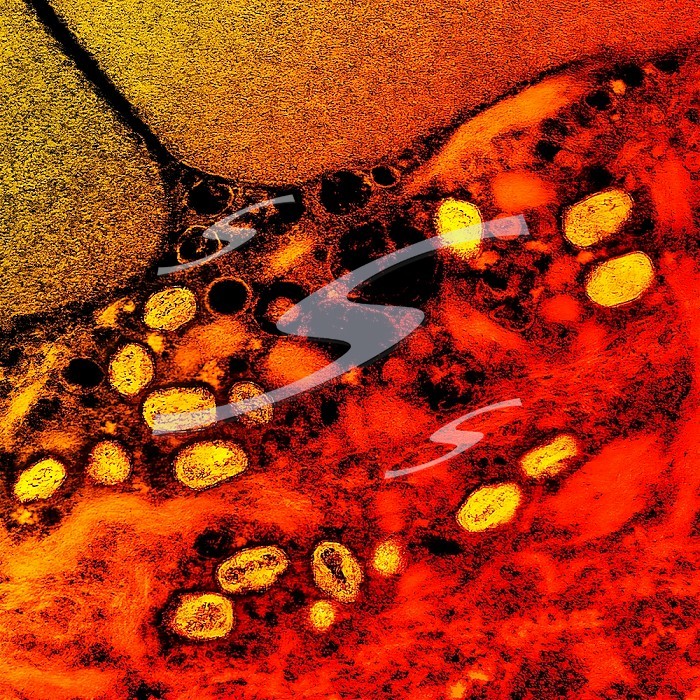 Colorized transmission electron micrograph of monkeypox particles (yellow) found within an infected cell (red), cultured in the laboratory.