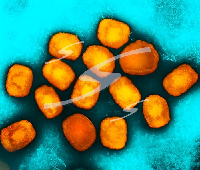 Colorized transmission electron micrograph of monkeypox virus particles (orange) cultivated and purified from cell culture.