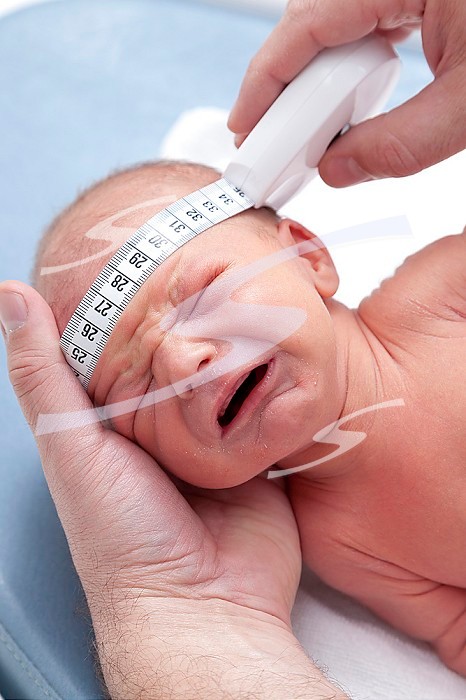 The pediatrician measures the head circumference. Saint Vincent de Paul Hospital, Lille.