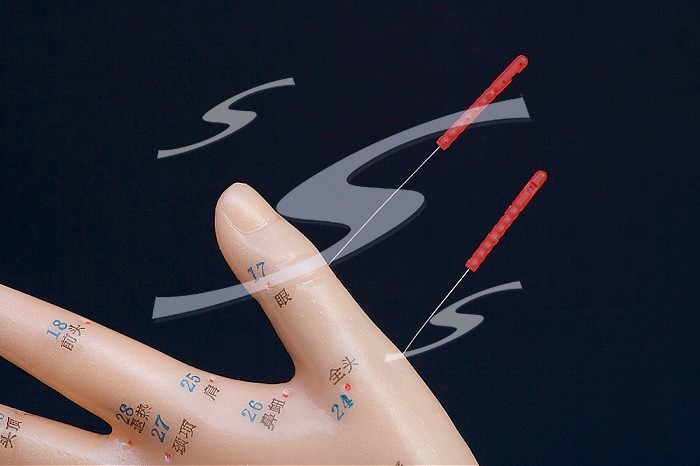 Human model with acupuncture needles inserted in acupressure points